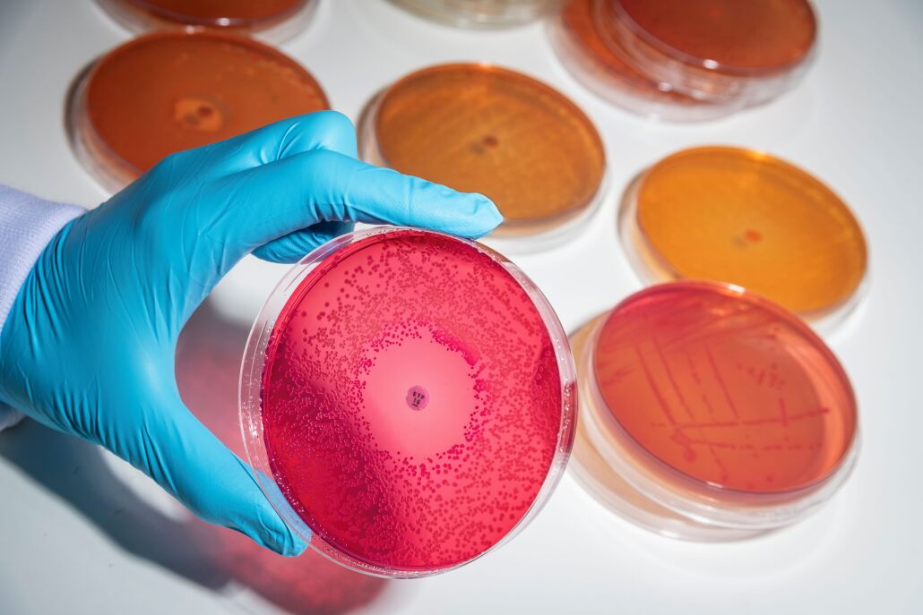 a rubber gloved hand holds a petri dish containing pink bacteria